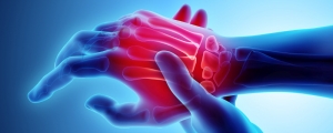 Understanding Arthritis: A Comprehensive Overview